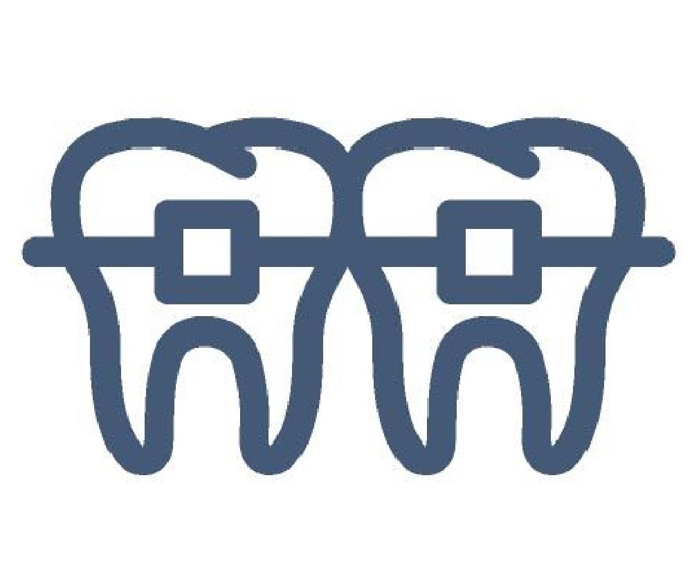 Braces and Aligners for teens and adults liverpool dental care