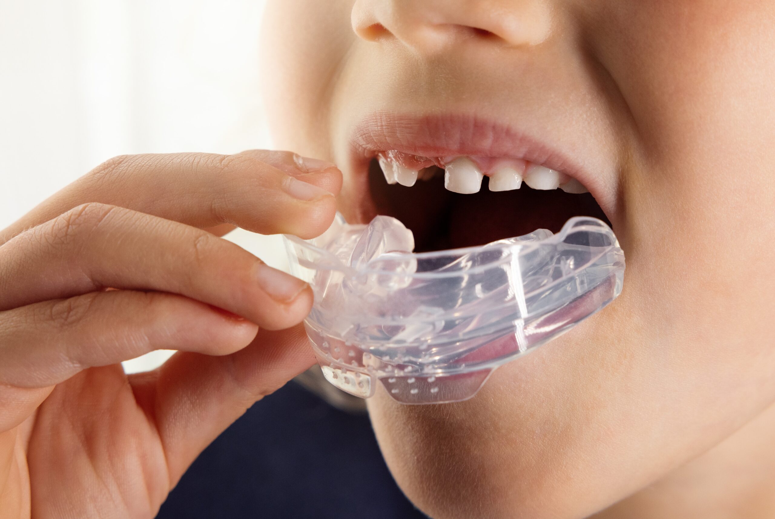 Myobrace Liverpool Dental Care Myobrace Liverpool Dental Care